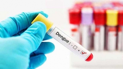 ডেঙ্গু পরীক্ষার উপকরণ আমদানিতে শুল্ক-কর প্রত্যাহার ডেঙ্গু পরীক্ষার উপকরণ আমদানিতে শুল্ক-কর প্রত্যাহার