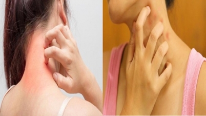 হঠাৎ ঝড়ে ত্বকের সমস্যা ও করণীয় হঠাৎ ঝড়ে ত্বকের সমস্যা ও করণীয়