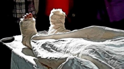 লাইফ সাপোর্টে রেখেই সেই মাদ্রাসাছাত্রীর অস্ত্রোপচার