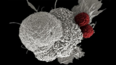 যে কারণে ক্যান্সারের ঝুঁকি পুরুষের বেশি যে কারণে ক্যান্সারের ঝুঁকি পুরুষের বেশি