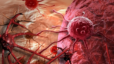 ‘শুরুতে চিহ্নিত হলে ক্যান্সার নিরাময় সম্ভব’ ‘শুরুতে চিহ্নিত হলে ক্যান্সার নিরাময় সম্ভব’