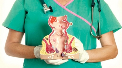 কোষ্ঠকাঠিন্য, অর্শ-পাইলস : কী করবেন ?(ভিডিও) কোষ্ঠকাঠিন্য, অর্শ-পাইলস : কী করবেন ?(ভিডিও)