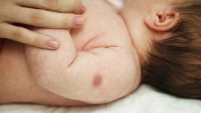 বিসিজি টিকা রক্ষাকবচ ! বিসিজি টিকা রক্ষাকবচ !