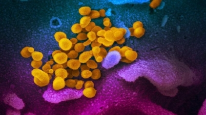 করোনা ভাইরাস পুরুষ বীর্যে ! করোনা ভাইরাস পুরুষ বীর্যে !