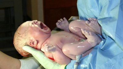 জন্মের পর শিশু কাঁদে কেন? জন্মের পর শিশু কাঁদে কেন?