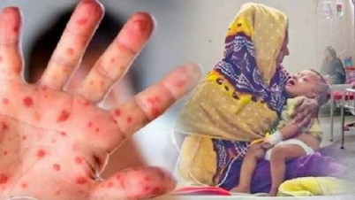 হামে মৃত্যু ছাড়াল ৪০০ হামে মৃত্যু ছাড়াল ৪০০