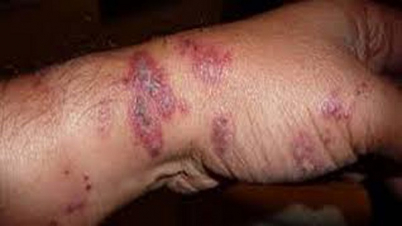 বিউবোনিক প্লেগ রোগে মৃত্যু, চীনে গ্রাম লকডাউন বিউবোনিক প্লেগ রোগে মৃত্যু, চীনে গ্রাম লকডাউন