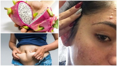 যে ফলে কমবে ওজন, দূর হবে ব্রণ যে ফলে কমবে ওজন, দূর হবে ব্রণ