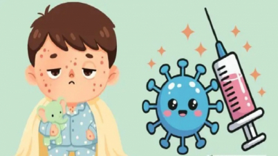 হাম কী, কেন ঝুঁকিপূর্ণ: সুরক্ষার উপায় জানুন